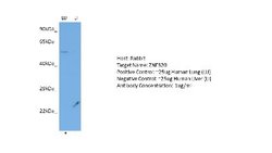 ZNF320 Rabbit anti-Human, Polyclonal, Novus Biologicals 0.1 mL | Buy Online | Novus Biologicals | Fisher Scientific